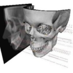 CBCT and Digital Orthodontics (ENG + NL + FR)