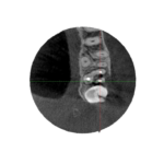 Module 2: CBCT Diagnostic Approfondi et Analyse d'Image