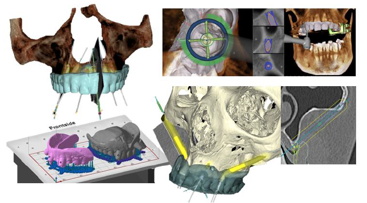 MASTERCLASS Digital MaxilloFacial Innovations: DAY2